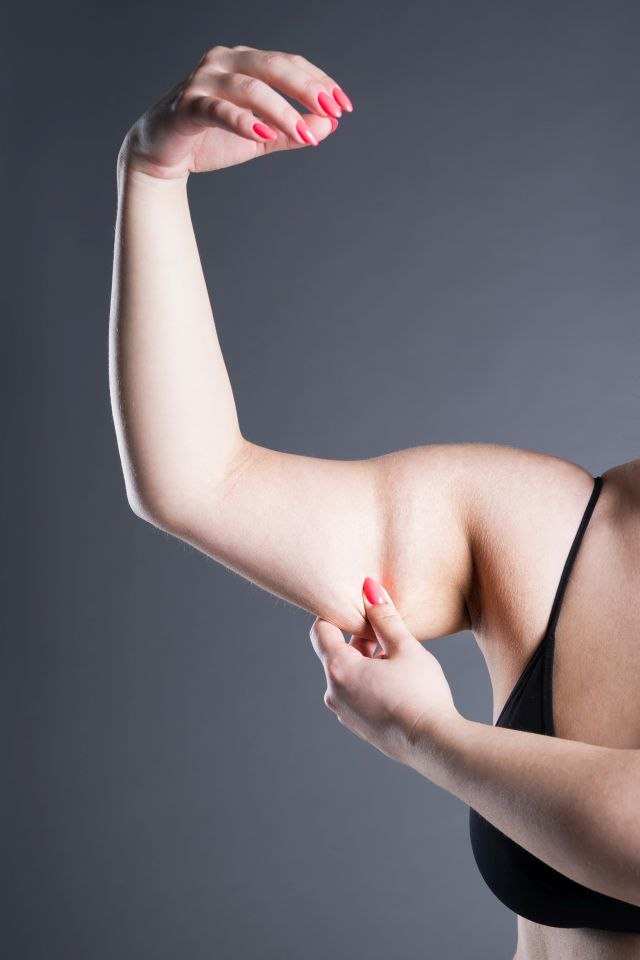 Kako da izbegnete opuštanje kože nakon naglog mršavljenja?